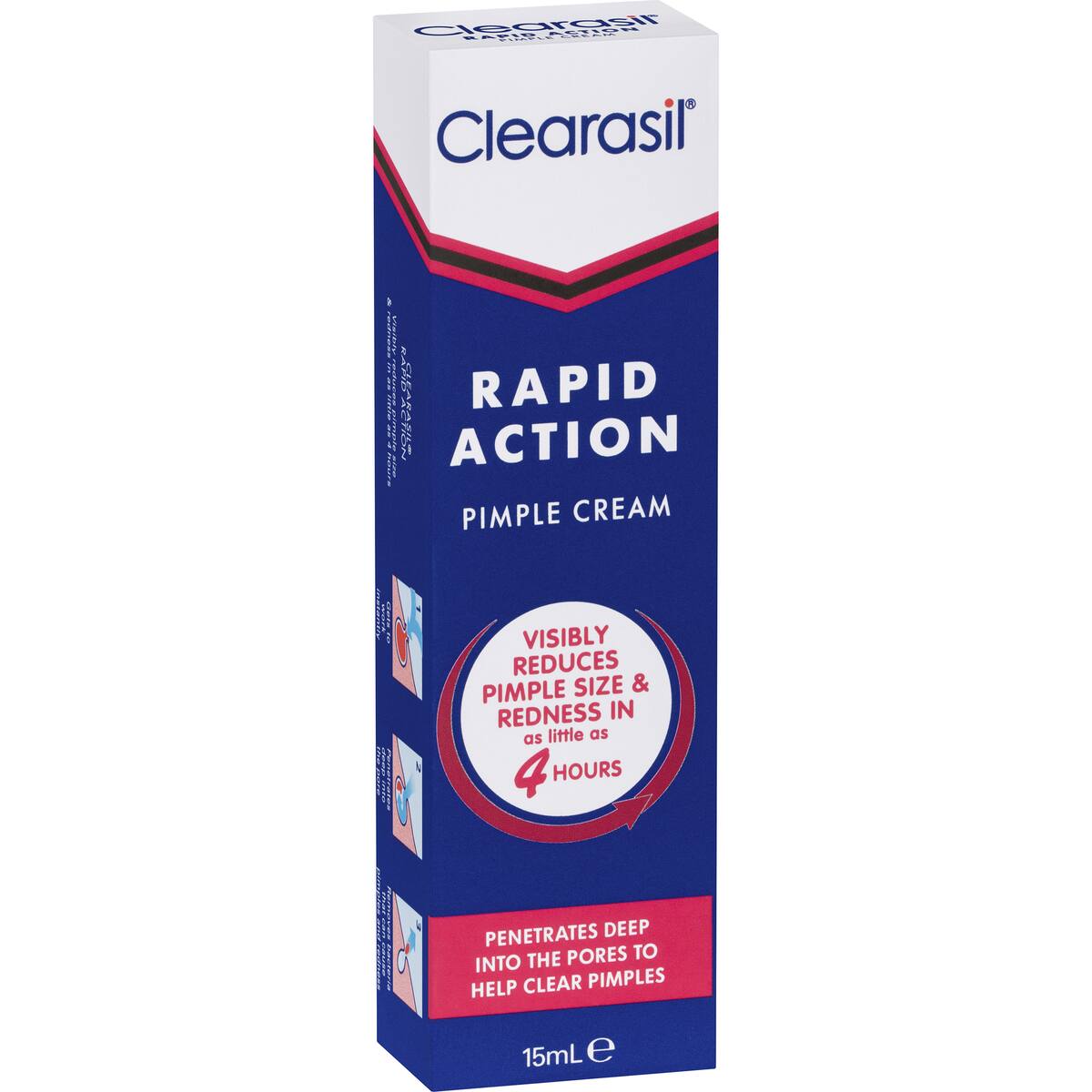 Clearasil Rapid Action Pimple Treatment Cream 15ml