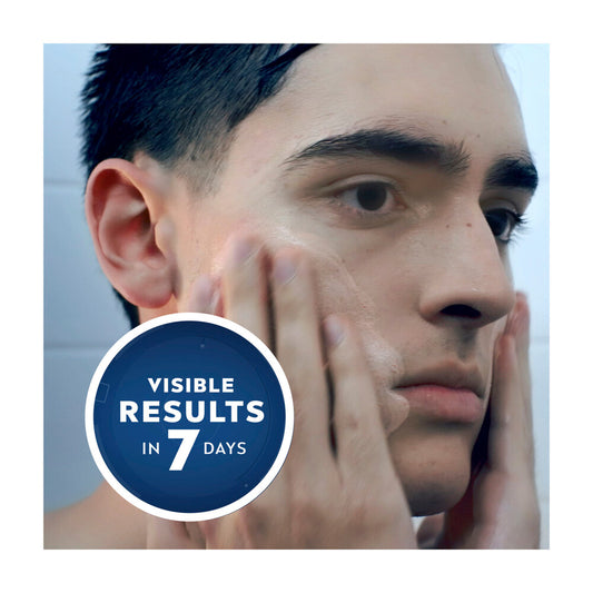 Nivea Men Deep Rapid Acne ear Face Wash - 150mL
