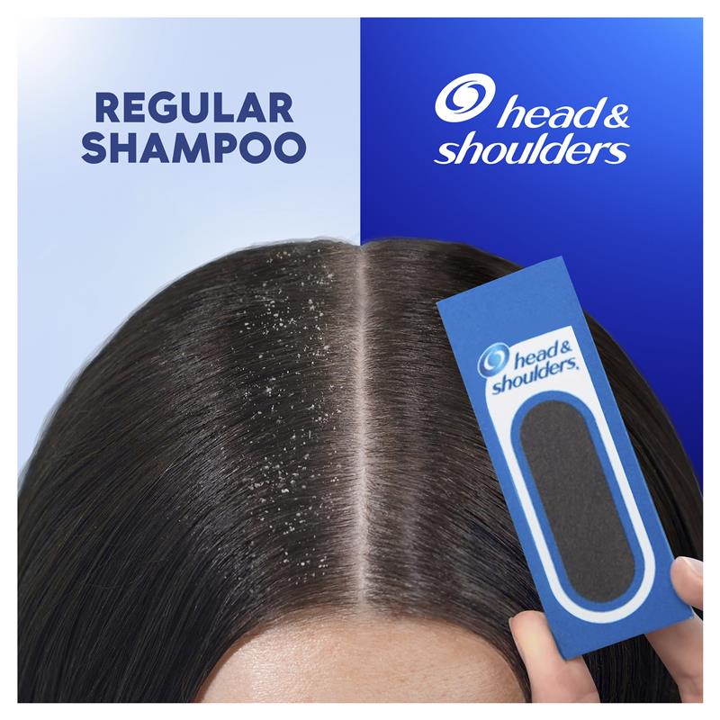 Head & Shoulders Dry Scalp Care Shampoo 400ml