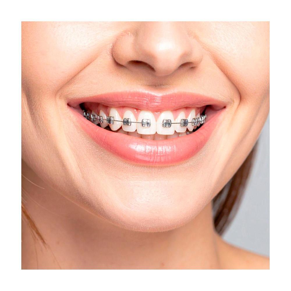 Colgate Neutrafluor Mouthwash Alcohol Free - 473mL