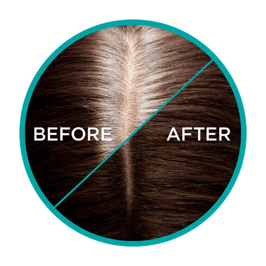 L'Oreal Magic Retouch Dark Brown - 75mL