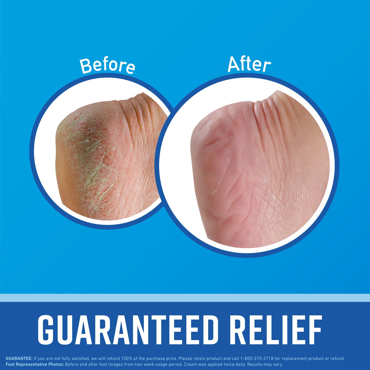 O'keeffe's Healthy Feet Foot Cream 85g