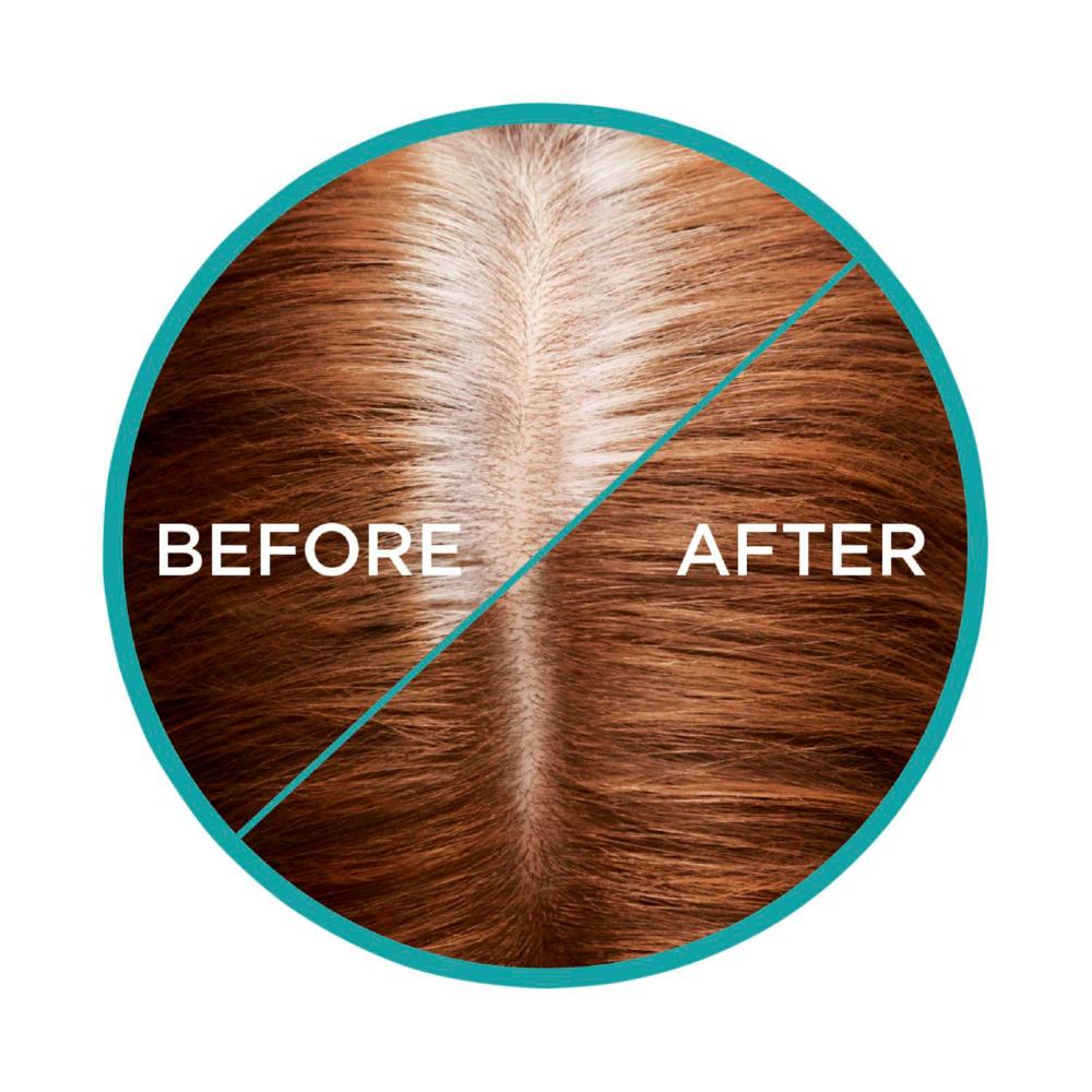 L'Oreal Paris Magic Retouch Auburn - 75mL