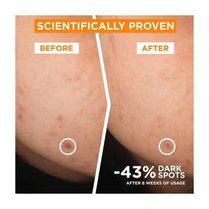 Garnier Vitamin C Serum - 30mL