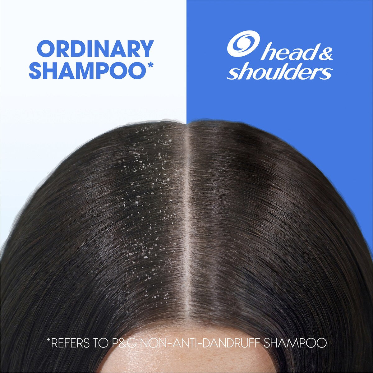 Head & Shoulders Dry Scalp Care Anti Dandruff Shampoo 850mL