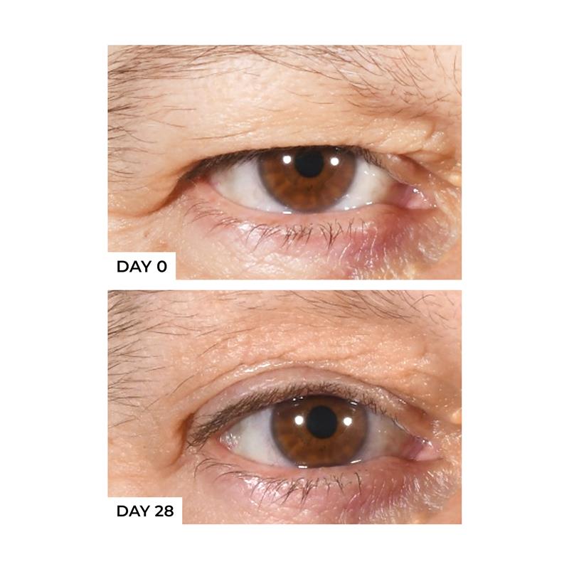 Freezeframe Eyelid Lift 15ml