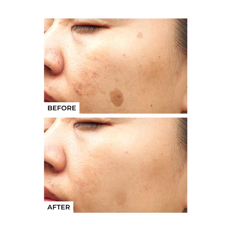 Freezeframe Pigment Clear Face Solutions 25ml