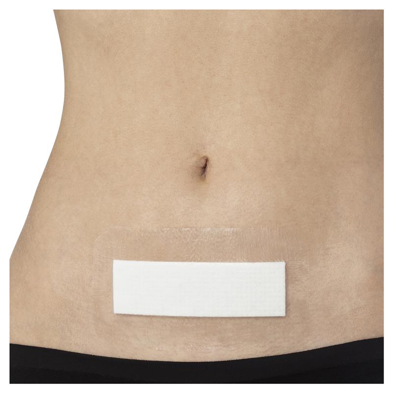 Opsite Post-Op Dressing - 15cm x 8cm - Single