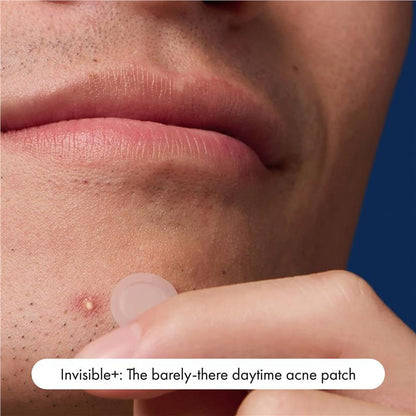 Hero Mighty Patch Variety 38pk - All-in-One Pimple Patch Solution