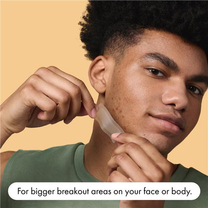 Hero Mighty Patch Surface 10 Pack - XL Pimple Patches for Breakouts