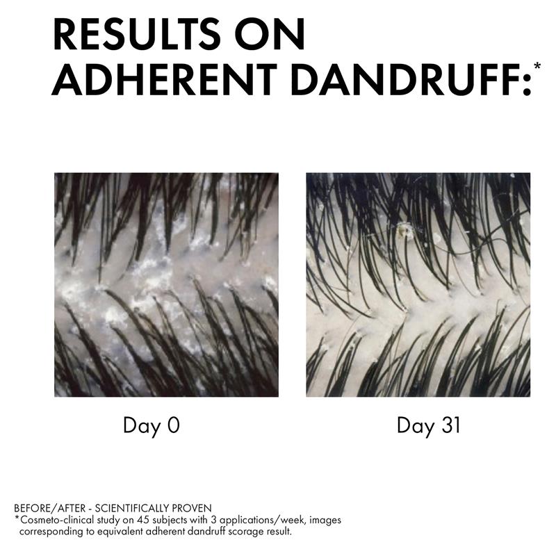 Dercos Anti-Dandruff DS Shampoo for Dry Hair 200ml