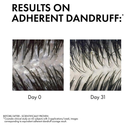 Dercos Anti-Dandruff DS Shampoo for Dry Hair 200ml