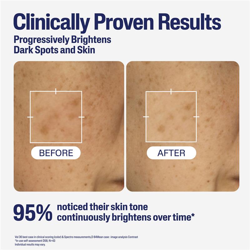 Cetaphil Bright Healthy Radiance Perfecting Serum 30ml