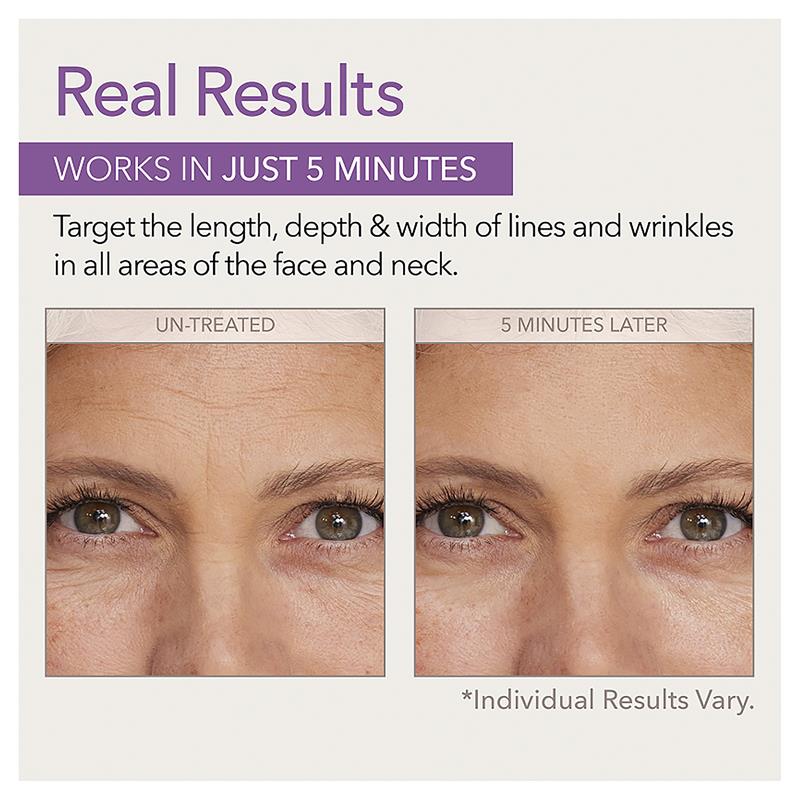 Skin Doctors Instant Wrinkle Filler 10ml