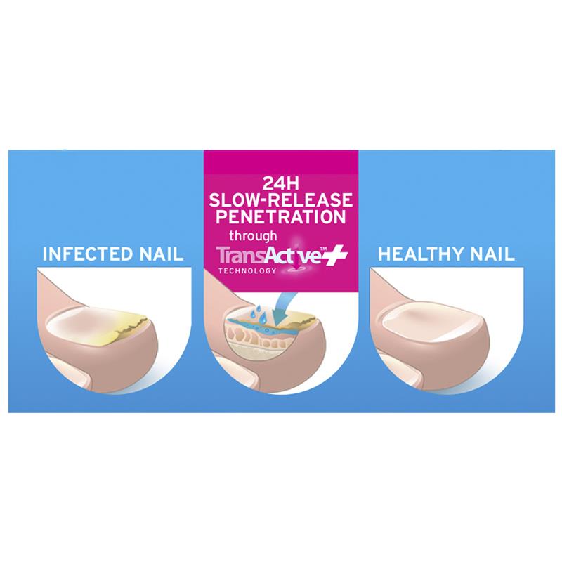 Excilor Ultra Fungal Nail Treatment 30ml