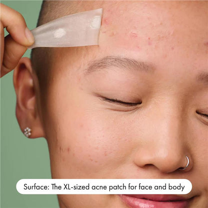 Hero Mighty Patch Variety 38pk - All-in-One Pimple Patch Solution