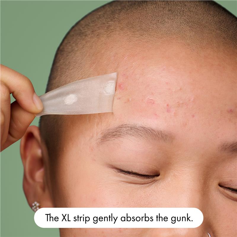 Hero Mighty Patch Surface Pimple Patches 10 pack