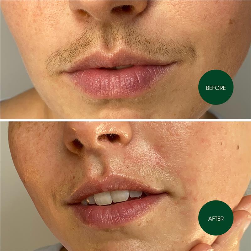 Nad's Facial Wax Strips - 20 Pack for Smooth Skin