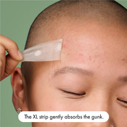 Hero Mighty Patch Surface 10 Pack - XL Pimple Patches for Breakouts