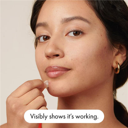 Hero Mighty Patch The Original 24 Pack - Overnight Pimple Treatment