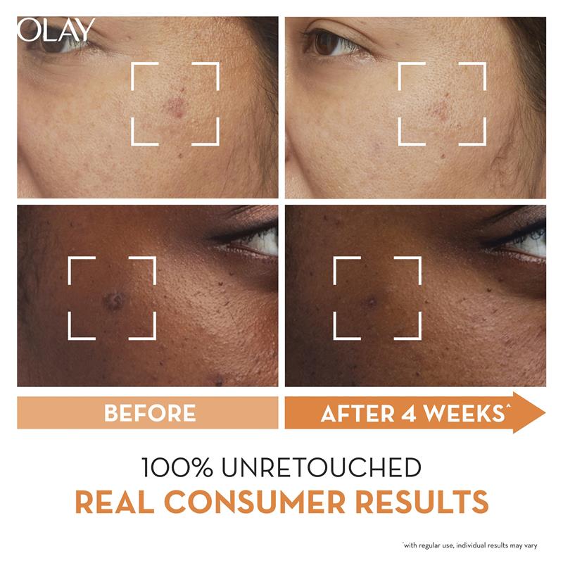 Olay Luminous Niacinamide + Vitamin C Moisturiser 50g