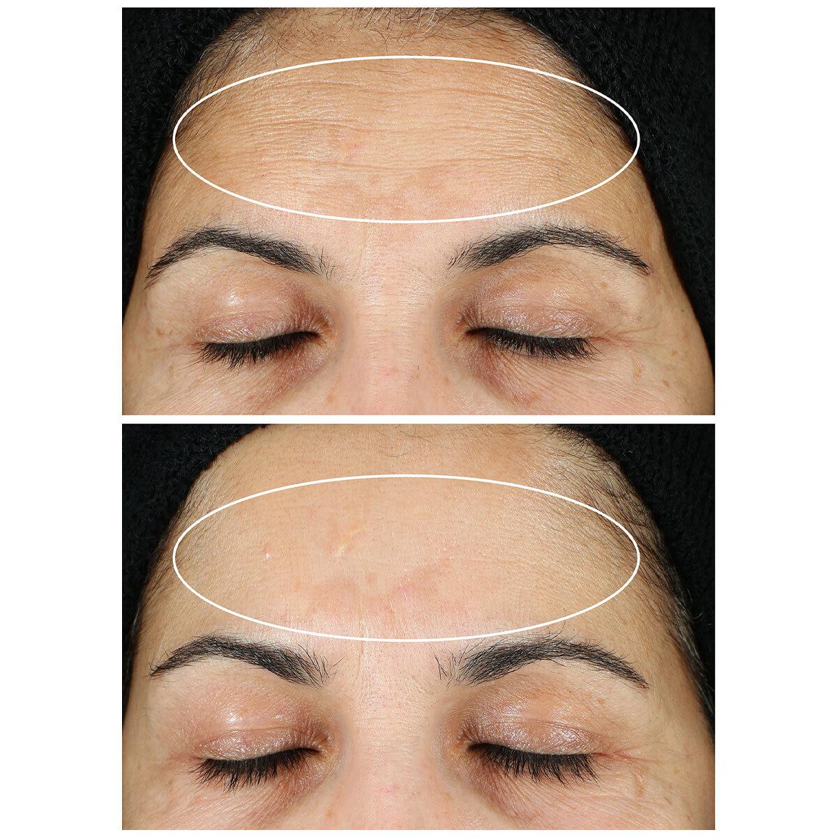 StriVectin Super-C Retinol Brighten And Correct Vitamin C Serum