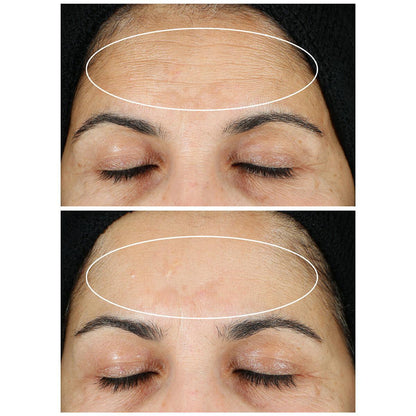 StriVectin Super-C Retinol Brighten And Correct Vitamin C Serum